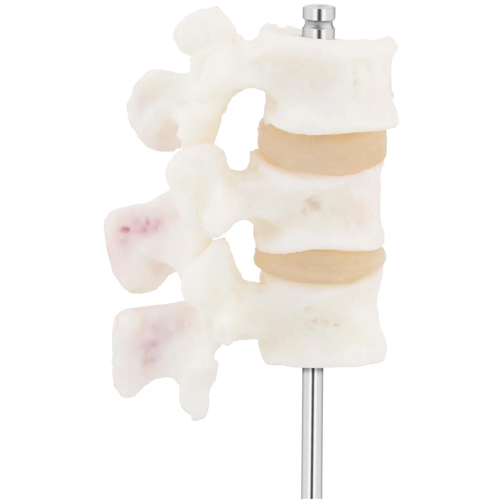 Modelo anatómico de vértebras lumbares - osteoporosis - en color