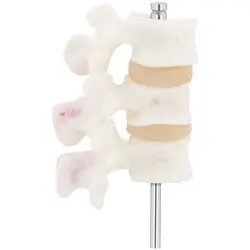Osteoporoza lędźwiowa - model anatomiczny