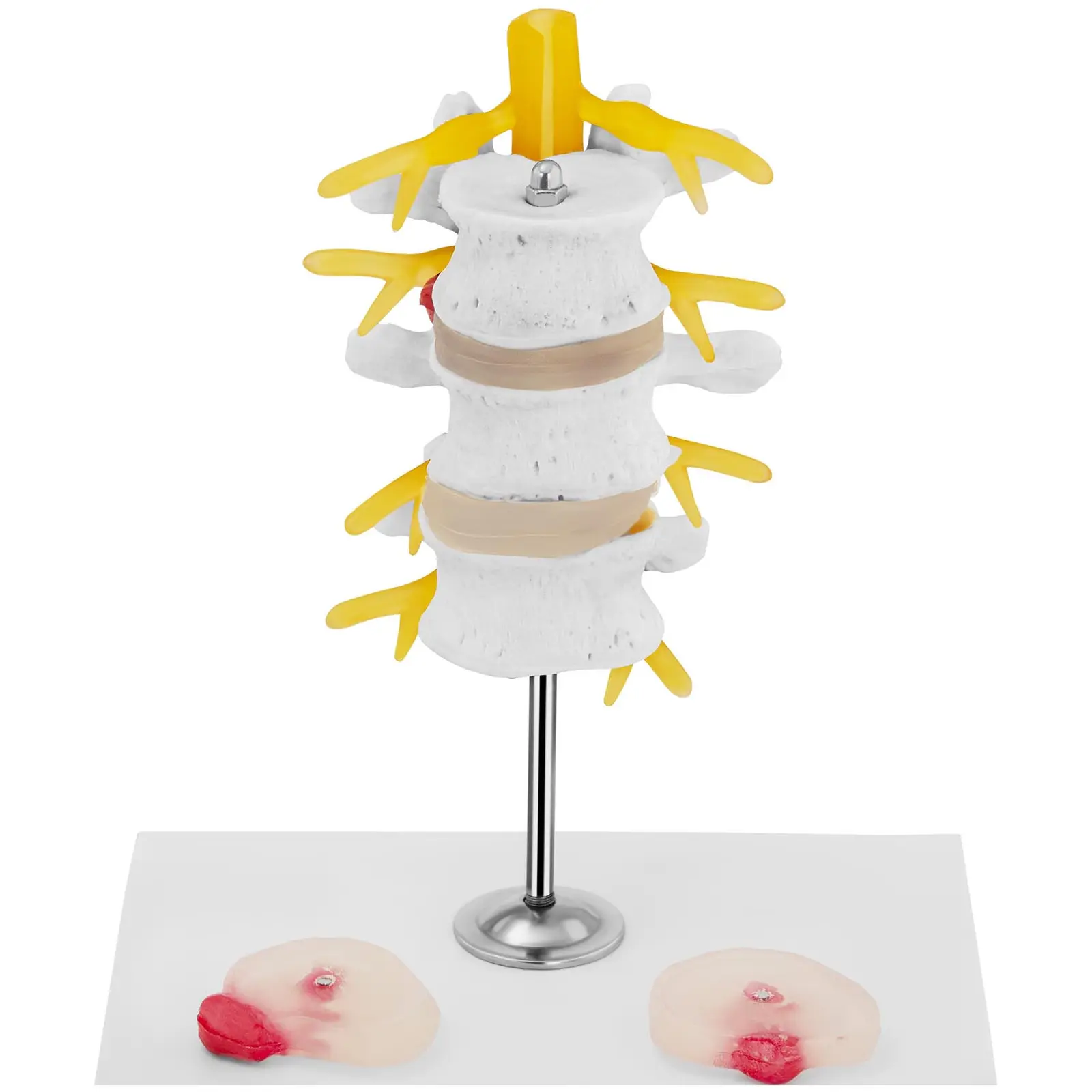 Seconda Mano Modello anatomico ernia del disco lombare - Colorato