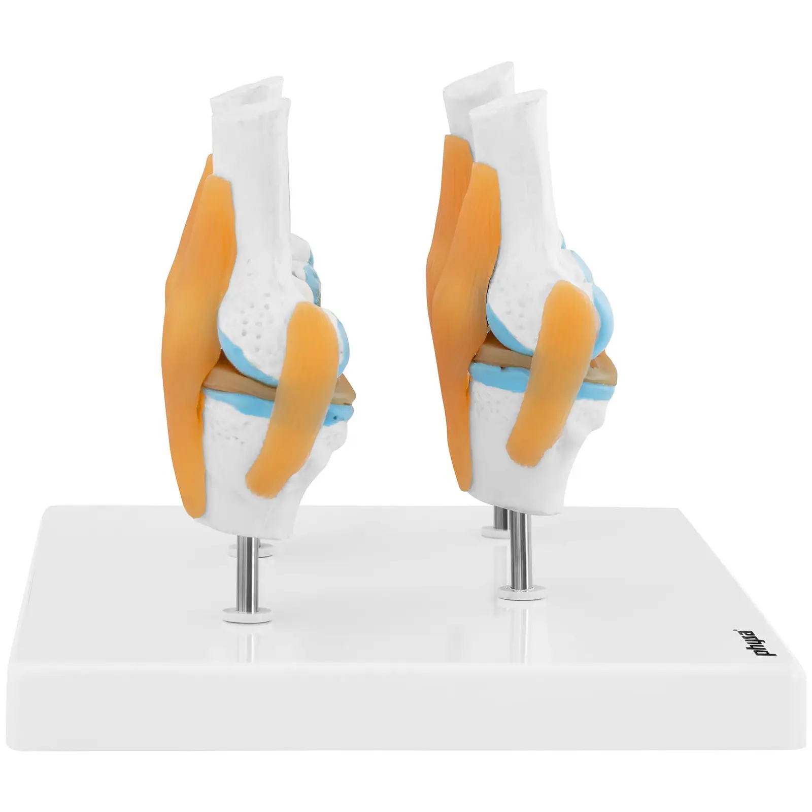 Modelo anatómico de rodilla - 4 estadios de artrosis - mitad del tamaño natural