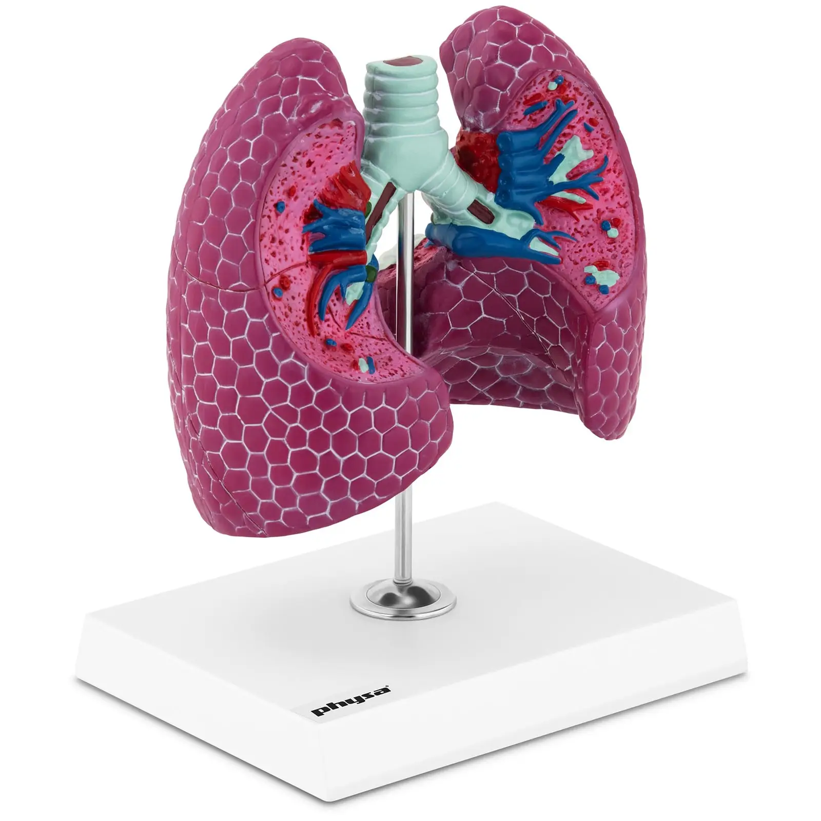 Modelo anatómico pulmonar - con patologías