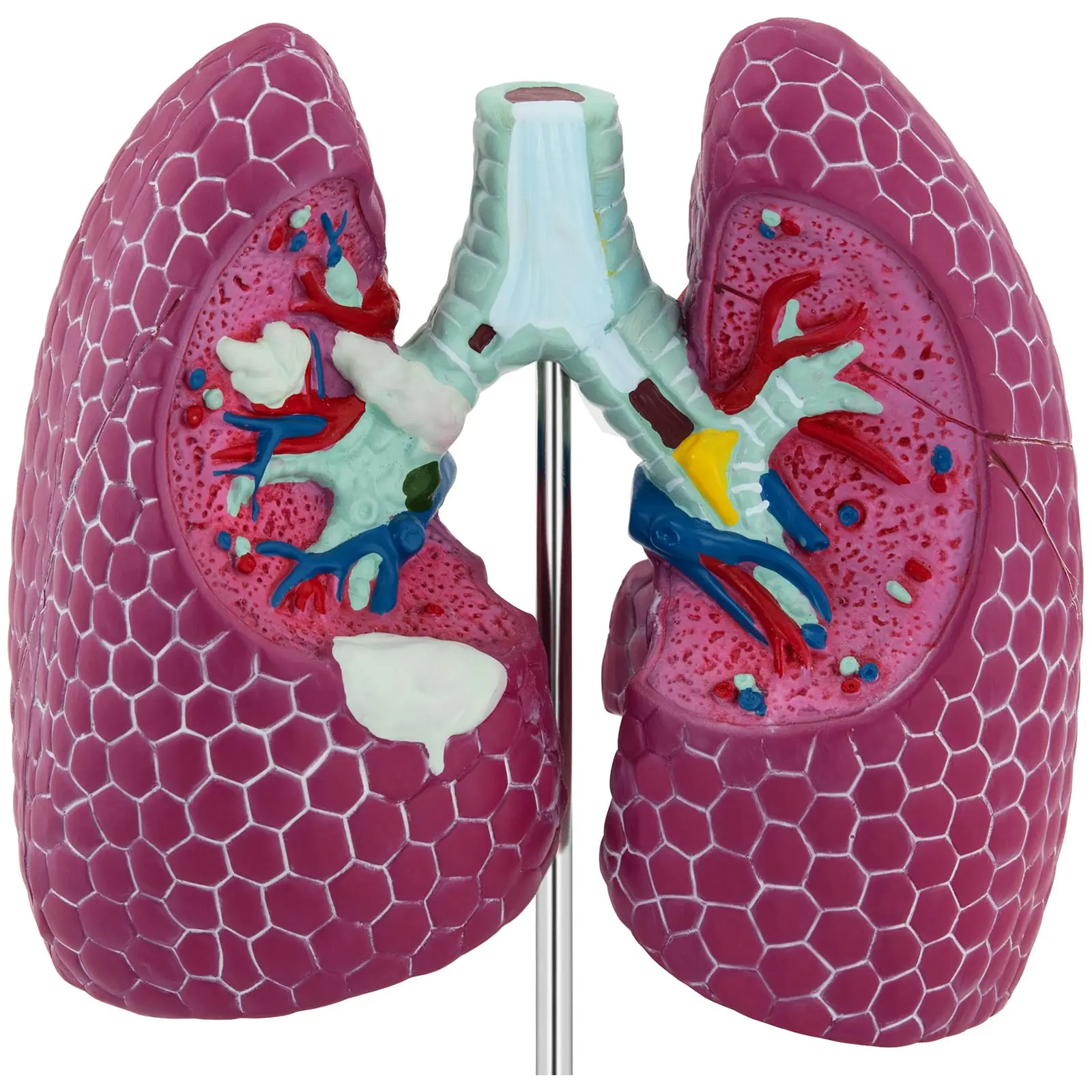 Model plic - s patologickými jevy