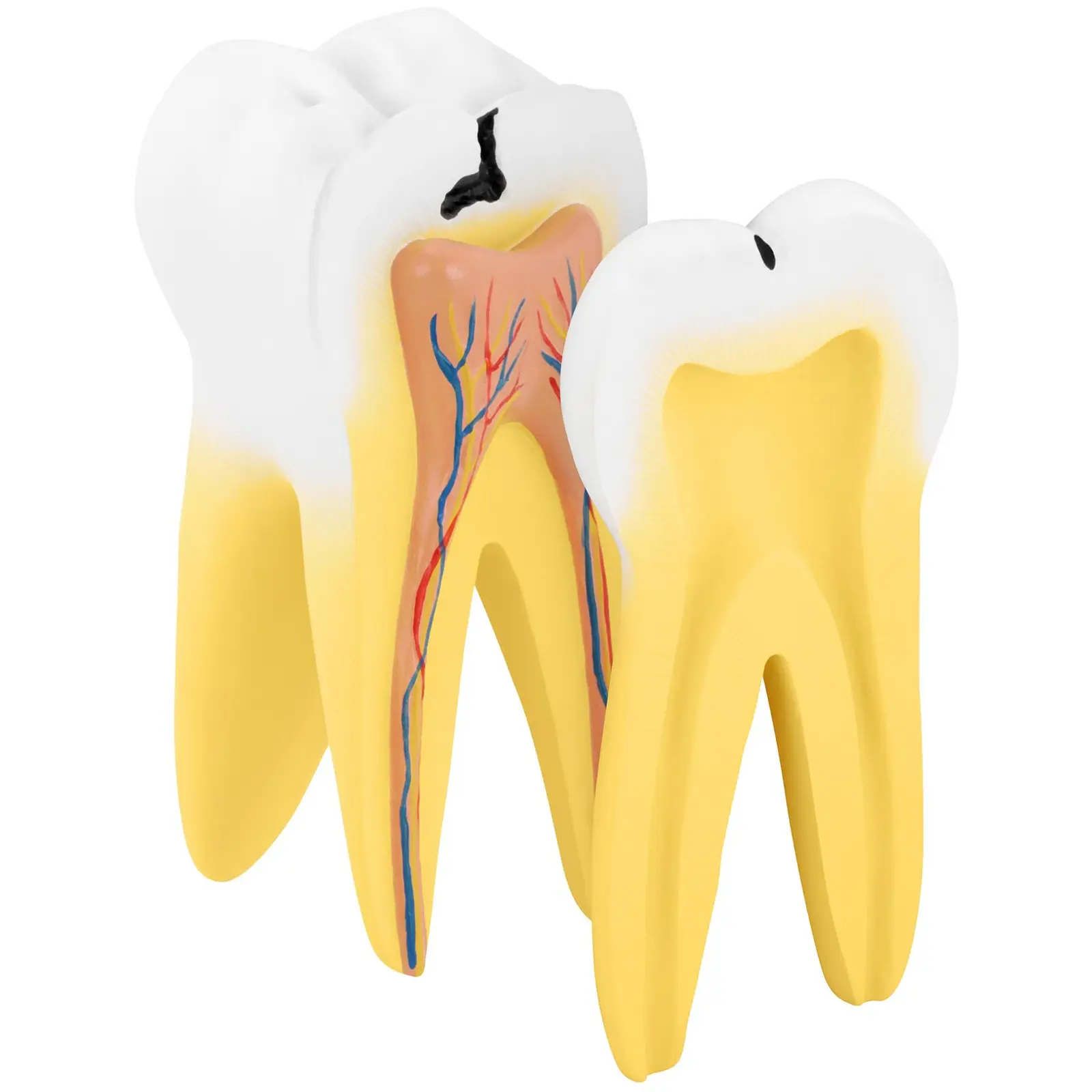 Modelo dental - molar con dos raíces - 2 piezas