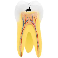 Modello anatomico dente molare a due radici - 2 parti