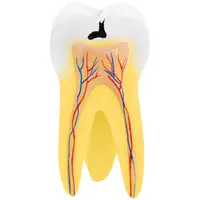 Zahnmodell - zweiwurzeliger Backenzahn - 2-teilig